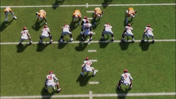 The Wishbone Overview