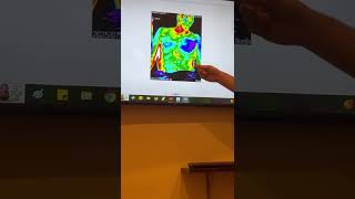Inside My Visit to Dr. Bergman’s Office – Testing, Live Results & Chiropractic Adjustments
