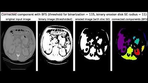 Mathematical Morphology | Algorithms | Applications | Erosion | Dilation | python