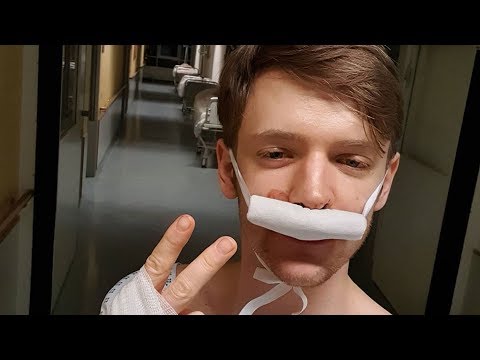Autsch! Was ist denn nur mit Hottie Timur Bartels passiert?  - Fox News