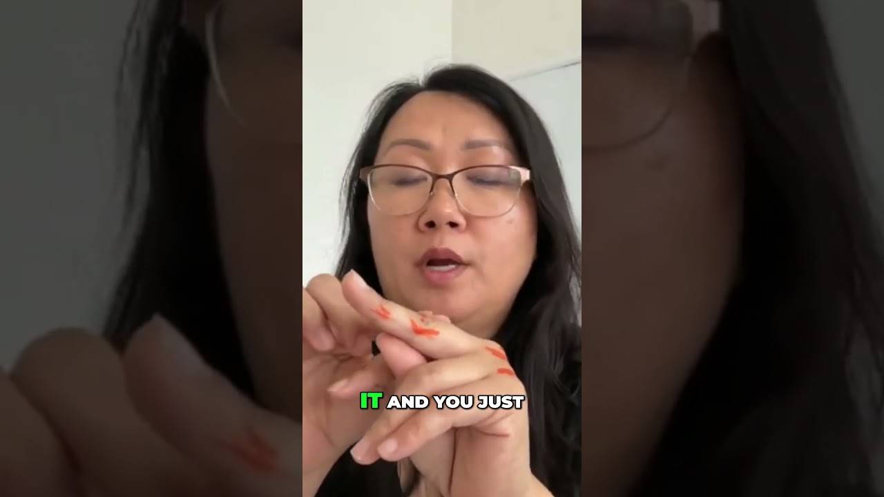 Treatment for a Sprained Finger 🖐️ Finger injuries can be tricky!