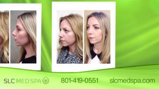 Advanced Video Montage Plus - Slc Med Spa