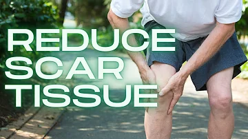 How to Get Rid of Knee Scar Tissue NOW (& Naturally)