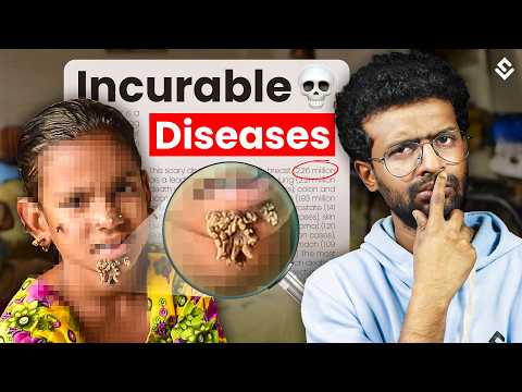 These Diseases Can Kill You (And There's NO Cure!)