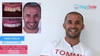 Magic Smile Turkey - Digital Smile Design Patient Review Andras