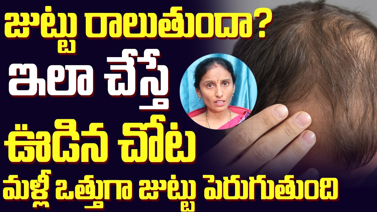 ఇలా చేస్తే ఊడిన ప్రతి వెంట్రుక వందల్లో పుడుతుంది || Hair Fall Control Tips in Telugu || CHC