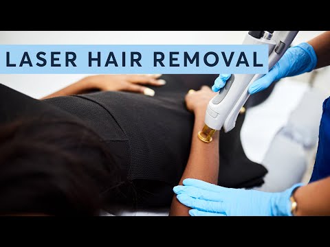 Laser Hair Removal in 1 Minute
