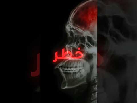 خطر على الدماغ اسمع ما هو