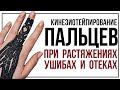 Кинезиотейпирование пальца при растяжениях, ушибах и гематомах.