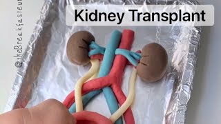 Playdough Surgery - Kidney Transplant