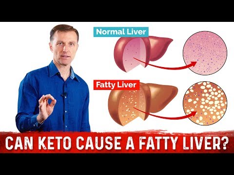 can-the-ketogenic-diet-cause-a-fatty-liver-without-enough-vegetables?