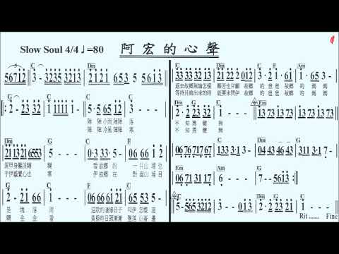 025阿宏的心聲Eb(導音)-伴奏,簡譜卡拉OK(kalaoke)音樂譜