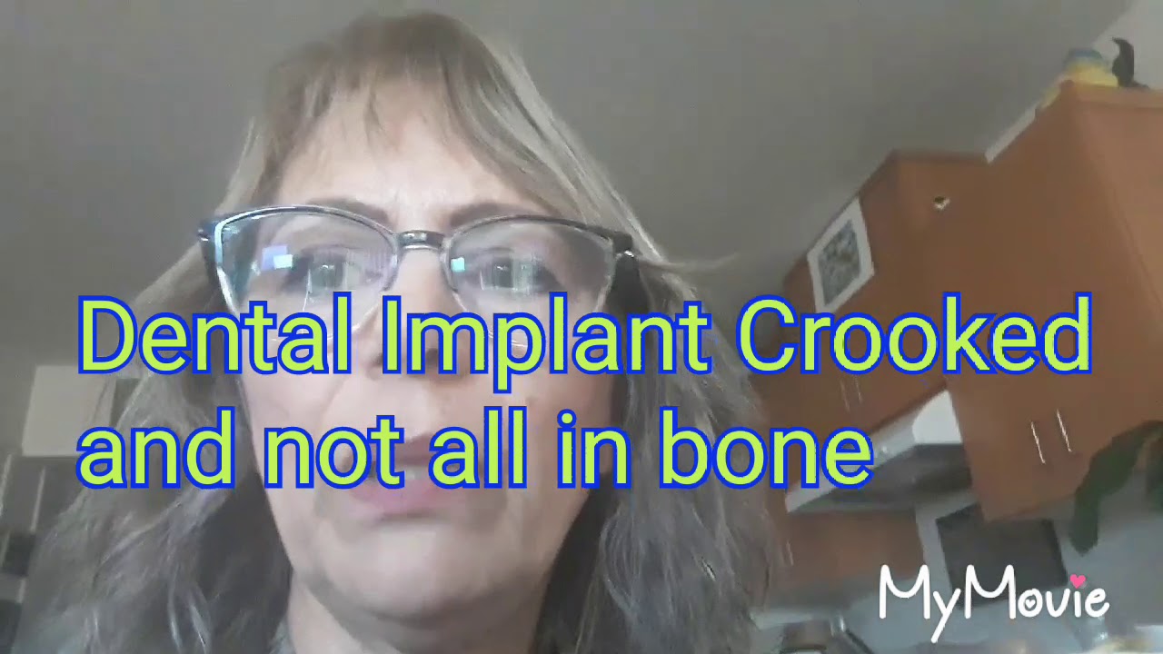 Uh Oh! Dental Implant Nightmare YouTube