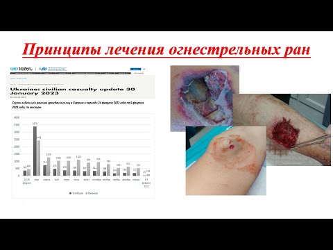 Огнестрельная травма гражданского населения. Принципы хирургической обработки огнестрельной раны.