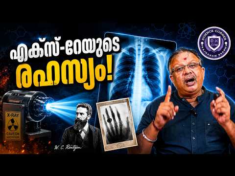 The Secret of X-Rays! | X-Ray | Shabu Prasad