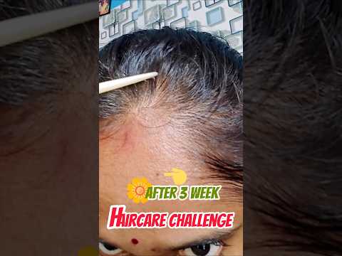 Hair Care Challenge Effect After 3 Weeks Result💃# #fashion #haircare #haircareroutine #rosemarywater