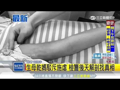 女童昏迷20天不治　周三解剖釐清有無虐童│三立新聞台