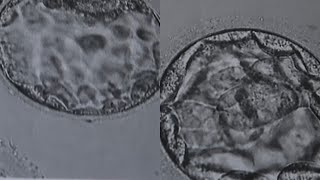 My IVF Journey To Twin Pregnancy | Lifestyle | Melanie Kate