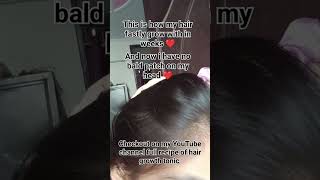 GROW YOUR HAIR FAST WITHIN WEEKS song haircare hairtonic healthyhair