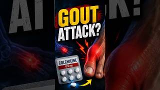 Sudden gout attack? Ye medicine kaafi use hoti hai! #gout #medicine