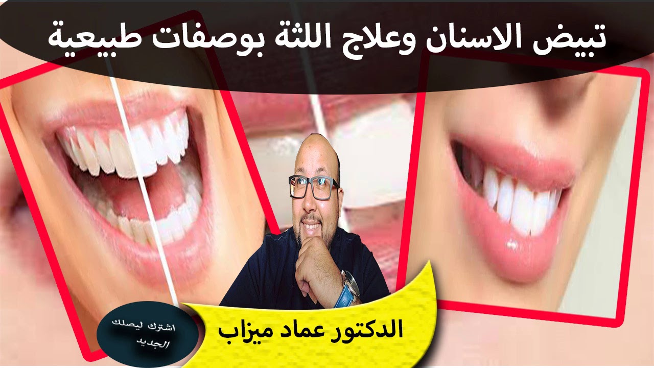 تبيض الاسنان وعلاج اللثة بوصفات طبيعية مع التحذير من بعض الوصفات المضرة الدكتور عماد ميزاب