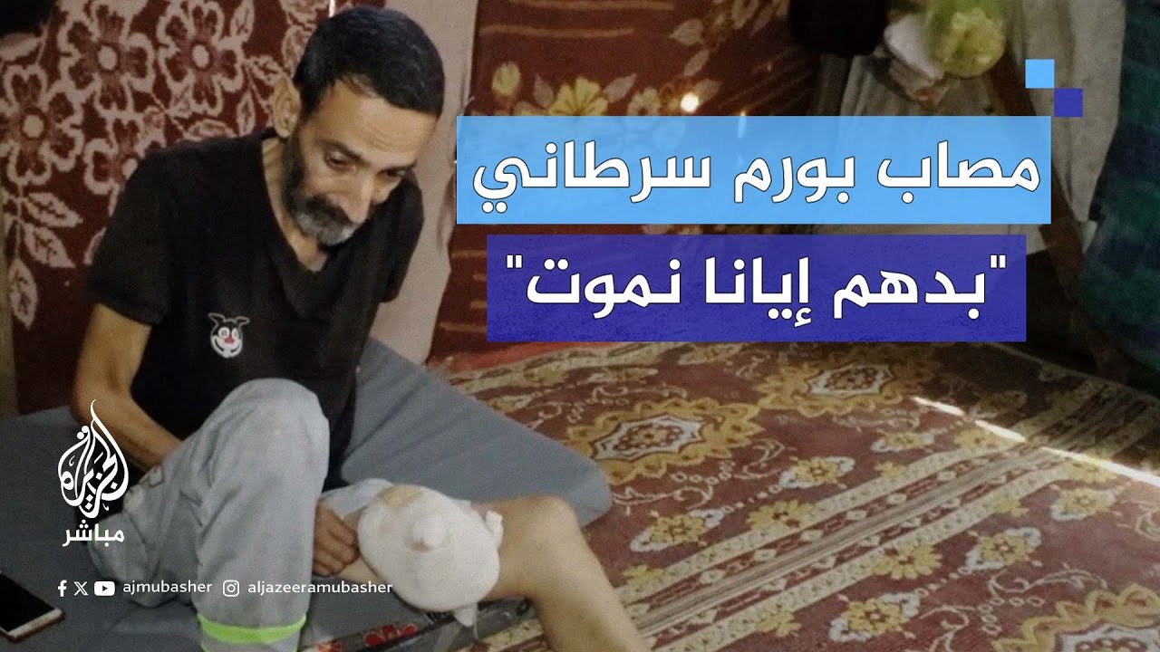 نازح فلسطيني مصاب بورم سرطاني وزنه نصف كيلو غرام: "بدهم إيانا نموت"
