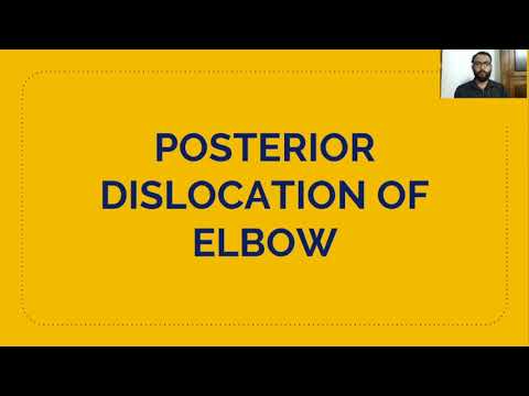 POSTERIOR DISLOCATION OF ELBOW