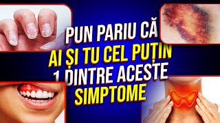 16 Simptome îți vor spune ce TIP de Vitamine îți Lipsesc!