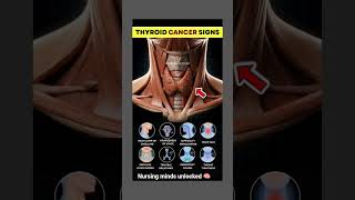 Thyroid Cancer signs #medical #medicalcounselling #nursing #medicalstudent #nursingstudent #gnm
