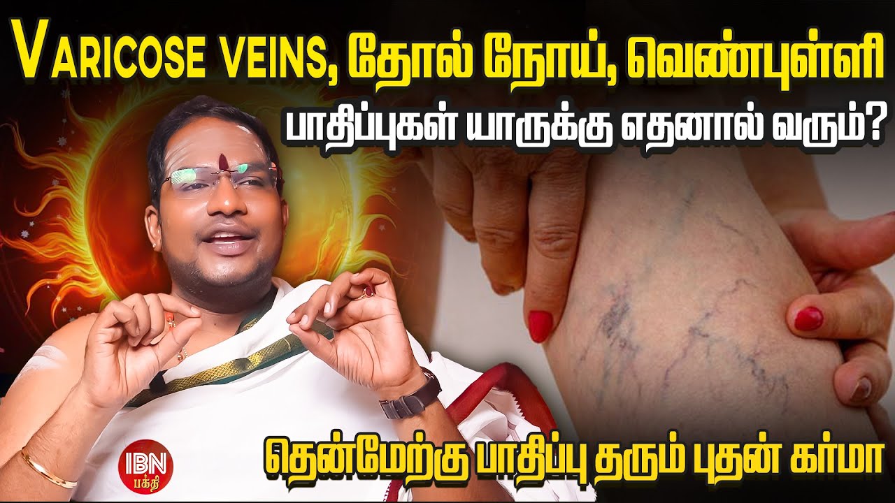 தோல் நோய்கள், வாதம், வேரிகோஸ் வெயின்ஸ் காரணம் ? | டாக்டர். சிவகுரு G.சத்தியசீலன் விளக்கம்