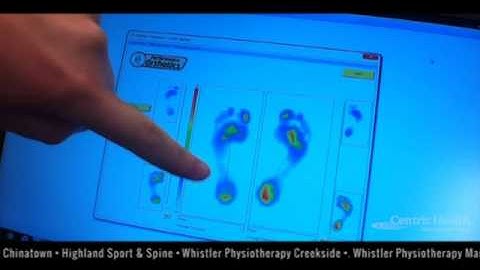 Centric Gait Analysis