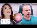 Dr Lee Is Scared To Operate On Patient Who Could Get Paralysed | Dr. Pimple Popper: This Is Zit
