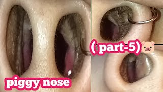 piggy nose challenge (part-5)//request vlog zoom camera and flashlight  challange vlog#dealy vlog#🤣