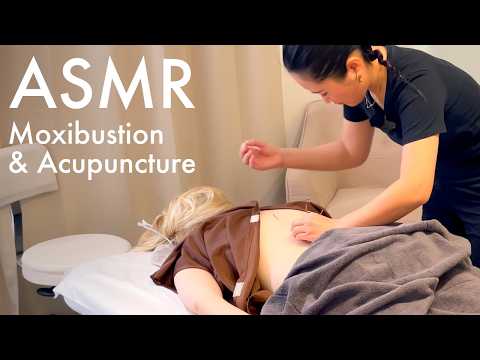 ASMR Acupuncture with Moxibustion (Unintentional ASMR, Real person ASMR)