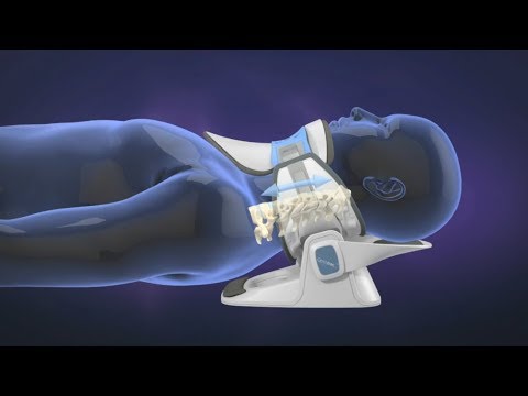 Cervical Traction System - Neck Pain Relief - YouTube