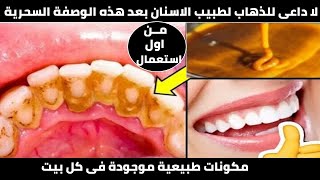 تبيض الاسنان في المنزل بمكونات سهله ومتوفره مش هتحتاجي تروحي لدكتور اسنان