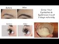 Grow your eyelashes & eyebrows in just 3 days | Eyelash and Eyebrow serum