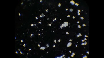 Spirillum and spirochete bacteria from freshwater sample