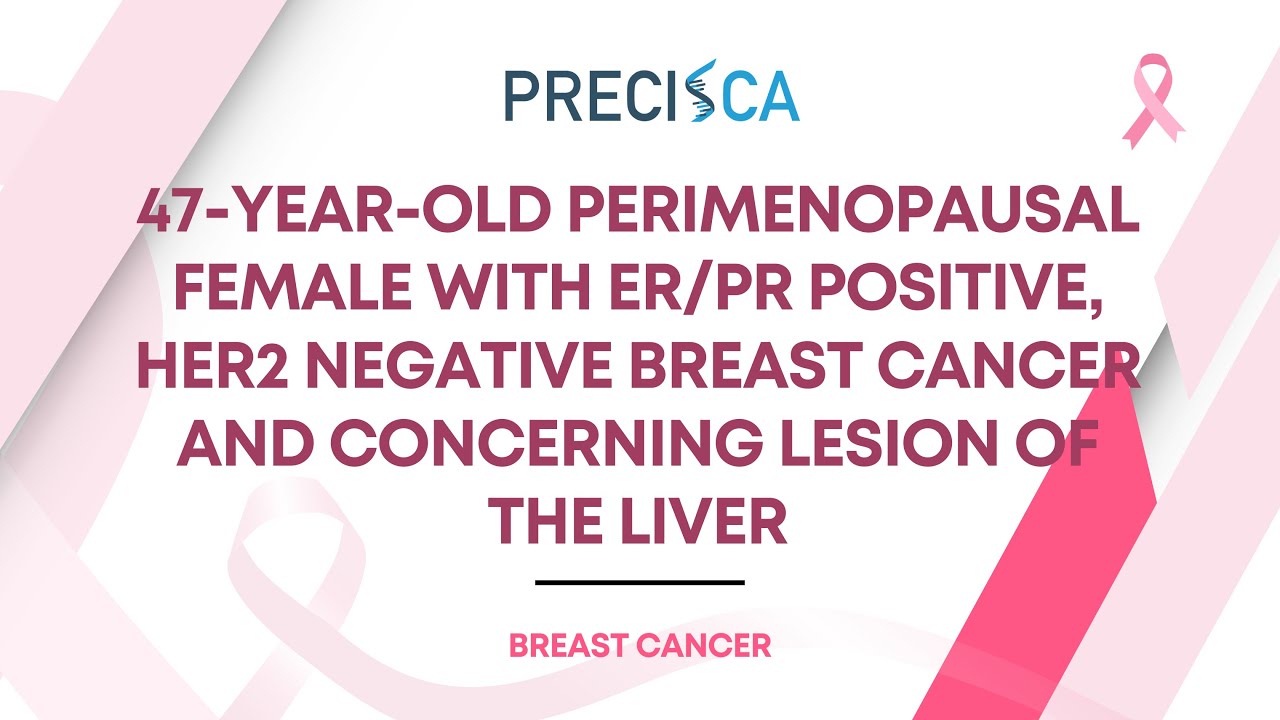Expert Cancer Panel: ER/PR positive, HER2 negative breast cancer and concerning liver lesion