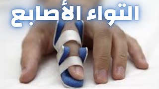 التواء الأصابع | علاج تمزق اصبع اليد| كيفية علاج جزع الاصبع| دكتور احمد حسن جمعه