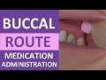Administering Medication via the Buccal Route