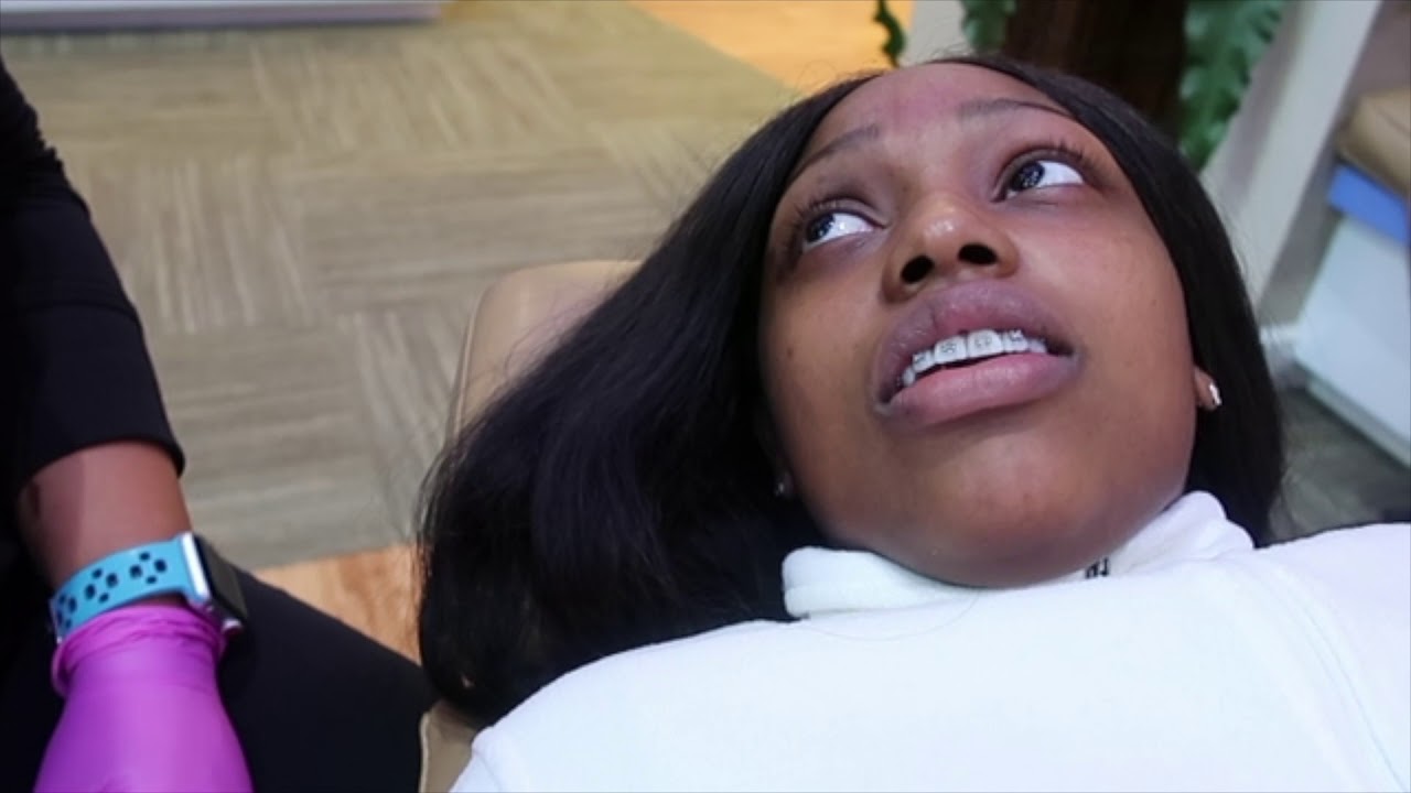 Braces Journey First Tightening YouTube