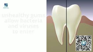 What Does a BPE Score Tell You About Gum Health
