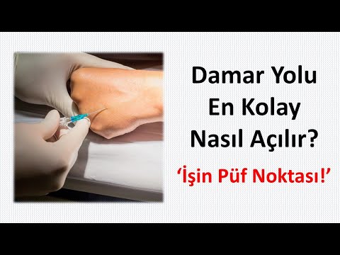 Damar Yolu Açma | İşin En Temel Püf Noktası