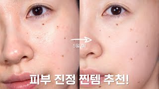 How to soothe damaged skin+products recommendation screenshot 1