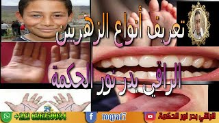 تعريف أنواع الزوهريين - Definition of types zouhri - HD