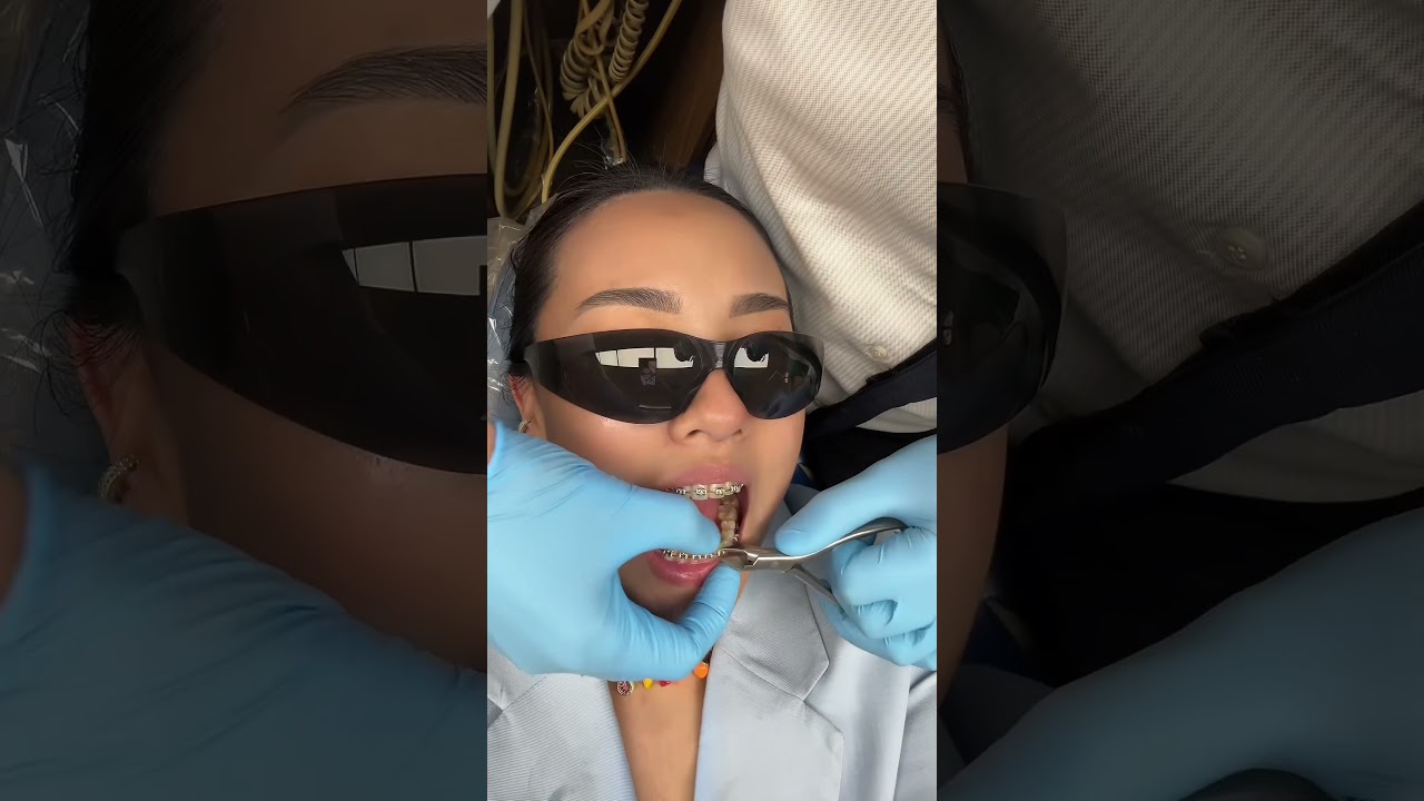 Больше никаких брекетов