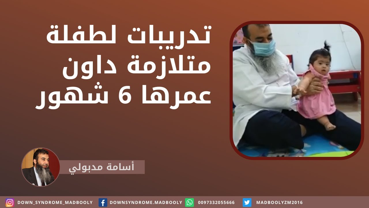 تدريبات  لطفلة متلازمة داون عمرها 6 شهور DOWNSYNDROME | مع اسامة مدبولي