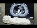 Beginning of video