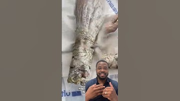 He didn’t shower for 5 YEARS! Doctors reaction #shorts